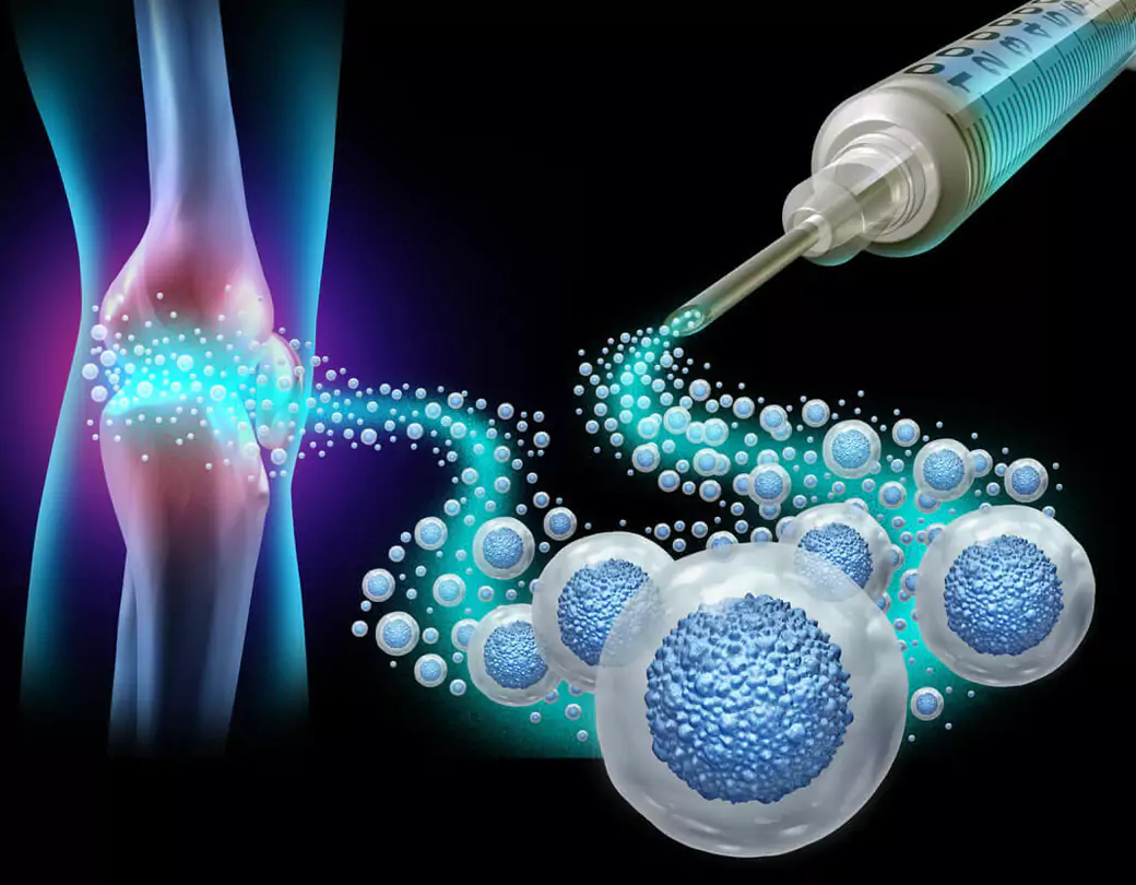 What Makes Cellular Therapy a Game-Changer in Regenerative Medicine?